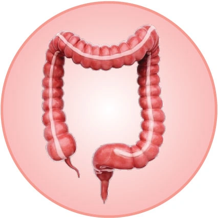 Colorectal